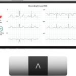kardiamobile6 leadpersonalekgmonitorsixviewsoftheheartdetects